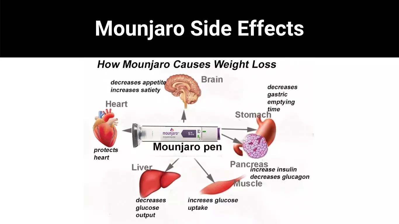 Mounjaro Side Effects