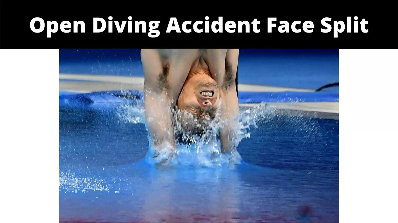 Open Diving Accident Face Split