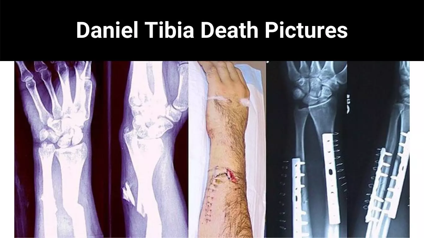 Daniel Tibia Death Pictures