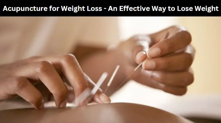 Acupuncture for Weight Loss - An Effective Way to Lose Weight