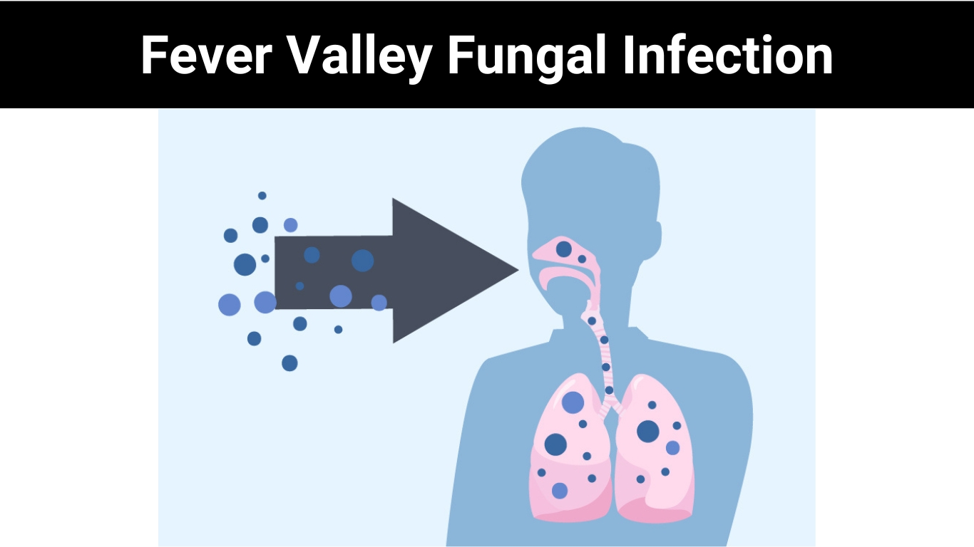 Fever Valley Fungal Infection