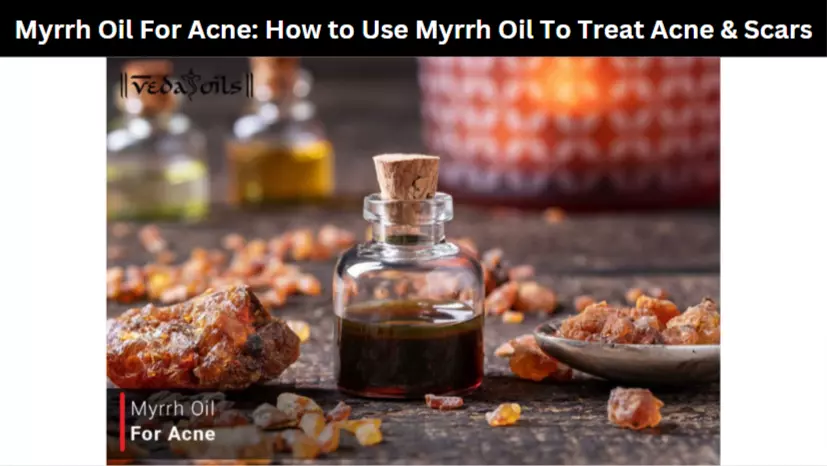 Myrrh Oil For Acne