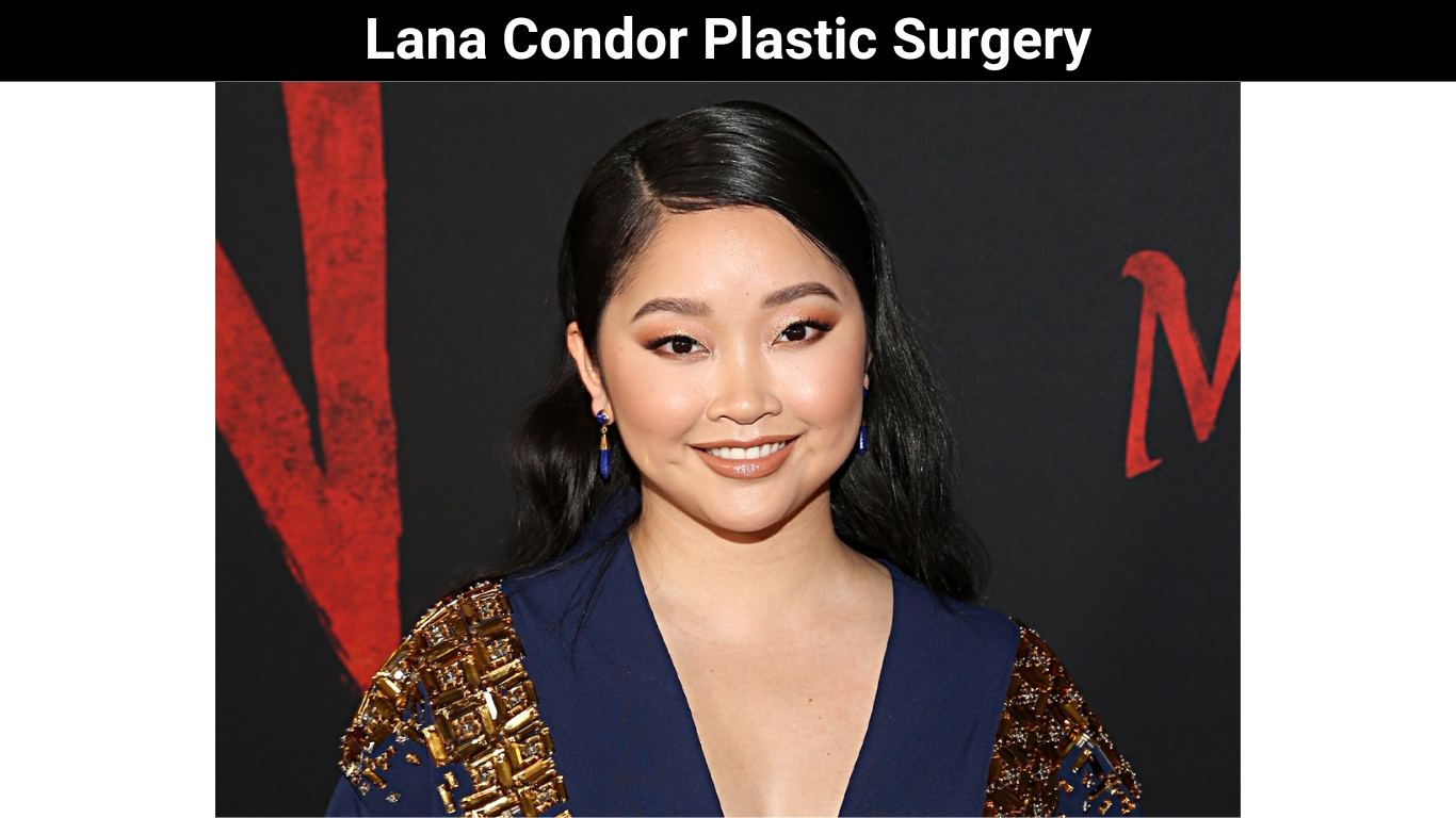 Lana Condor Plastic Surgery