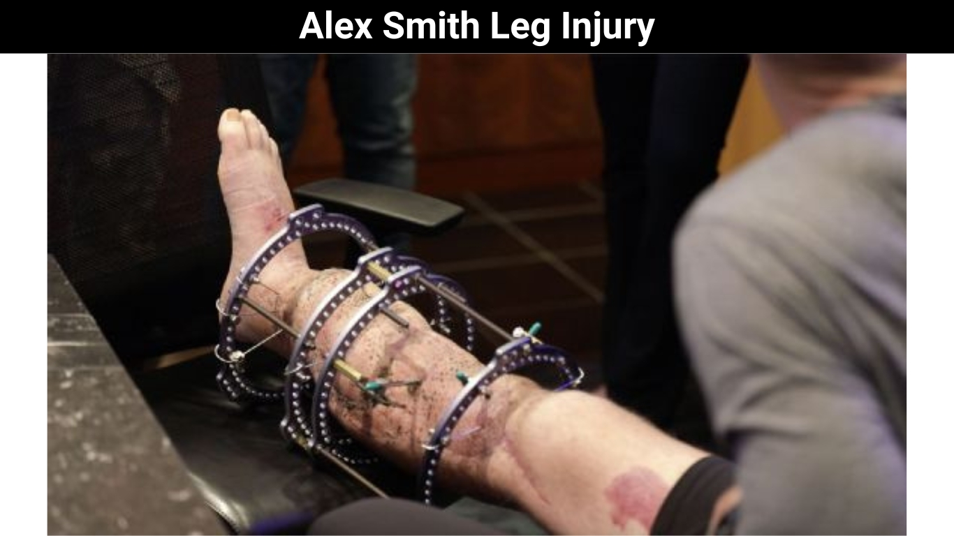 Alex Smith Leg Injury