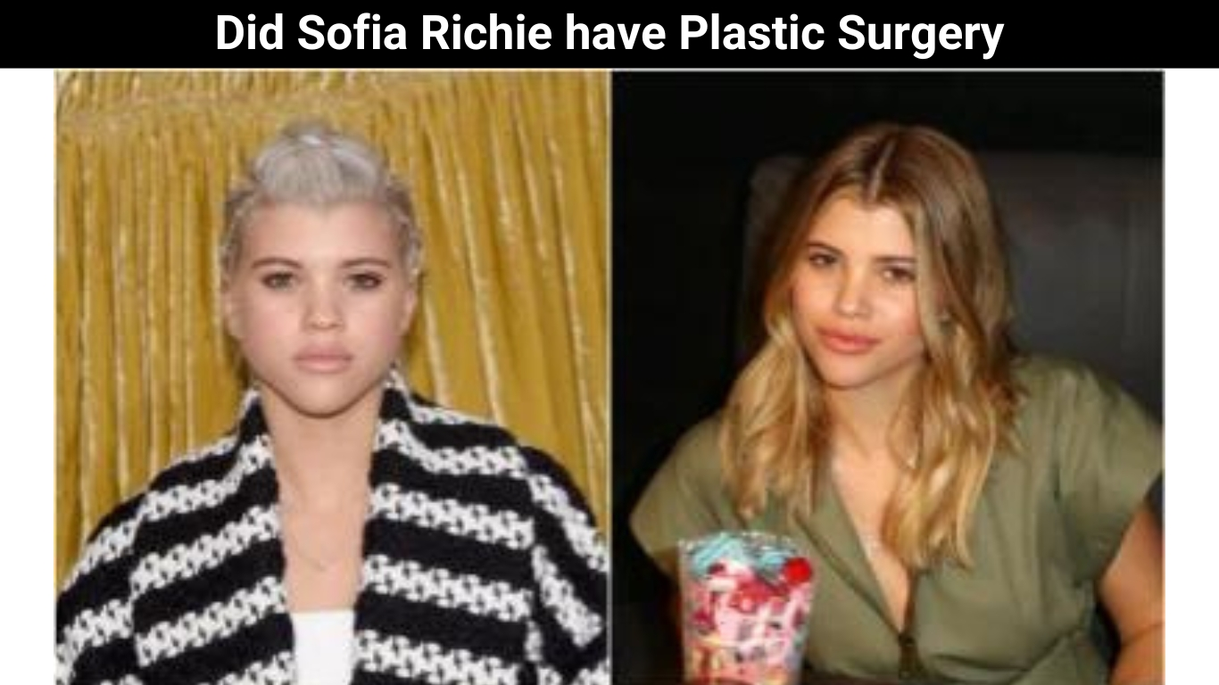 Did Sofia Richie have Plastic Surgery