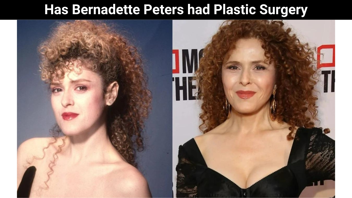 Has Bernadette Peters had Plastic Surgery