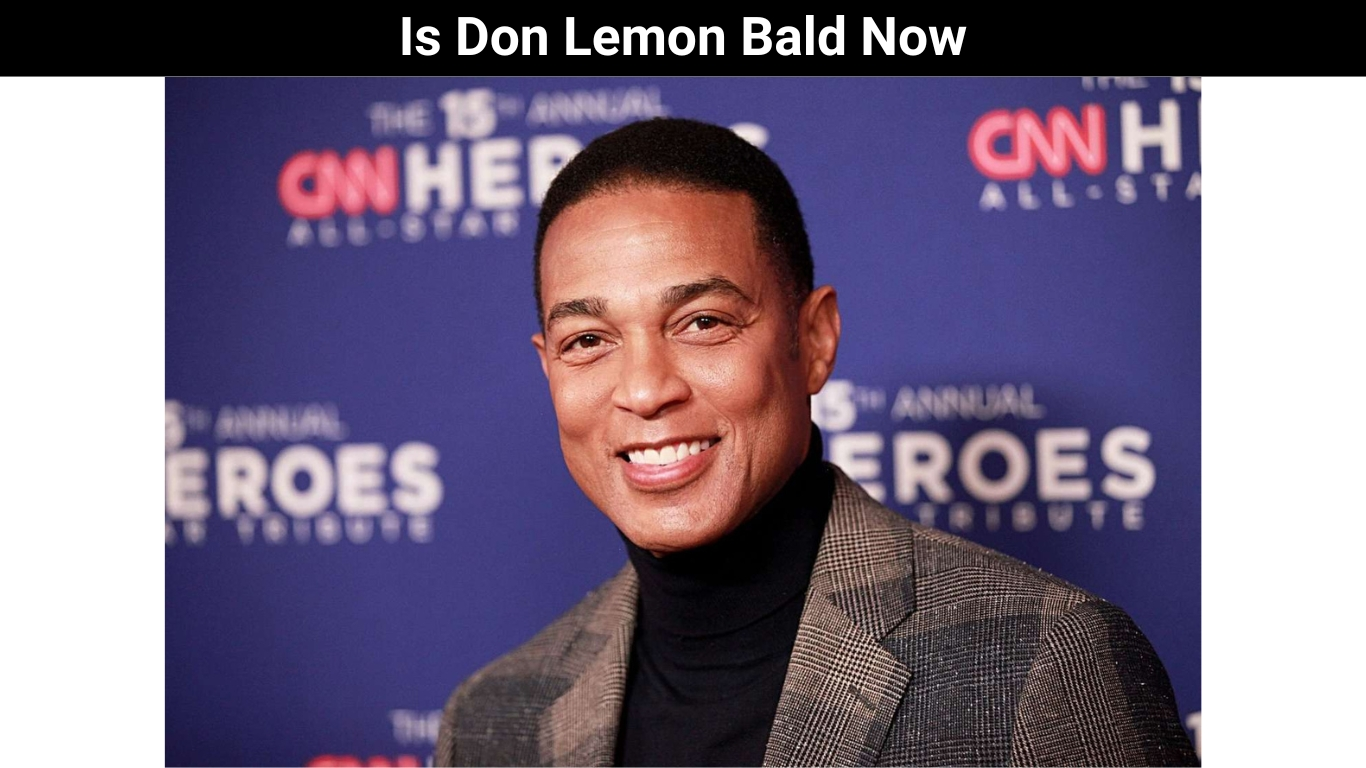 Is Don Lemon Bald Now