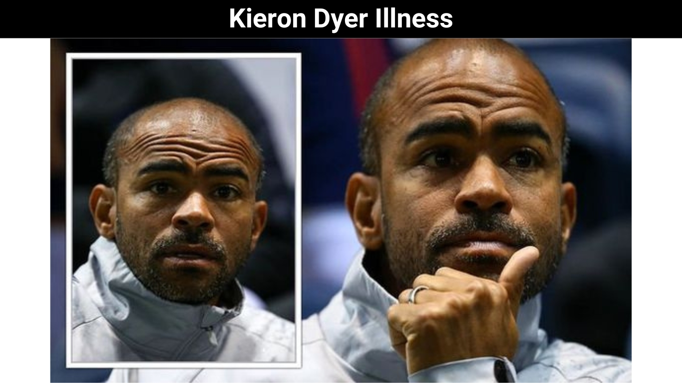 Kieron Dyer Illness