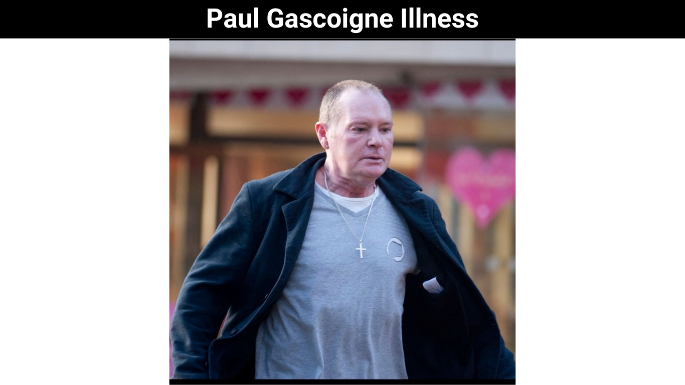 Paul Gascoigne Illness