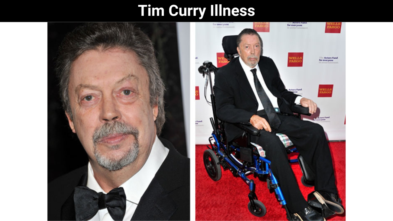 Tim Curry Illness