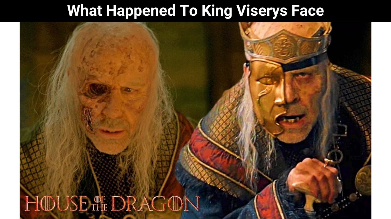 What Happened To King Viserys Face