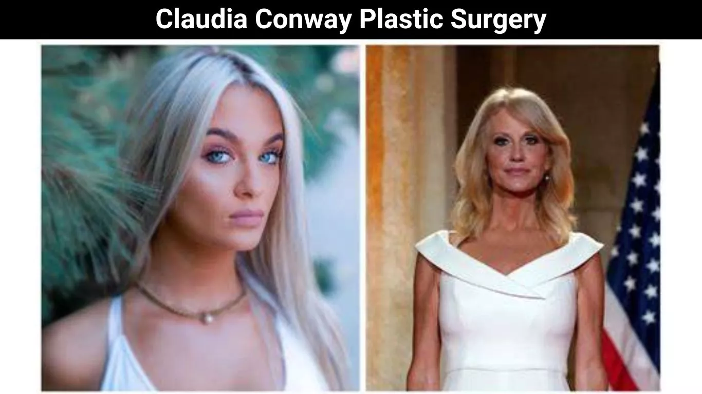 Claudia Conway Plastic Surgery