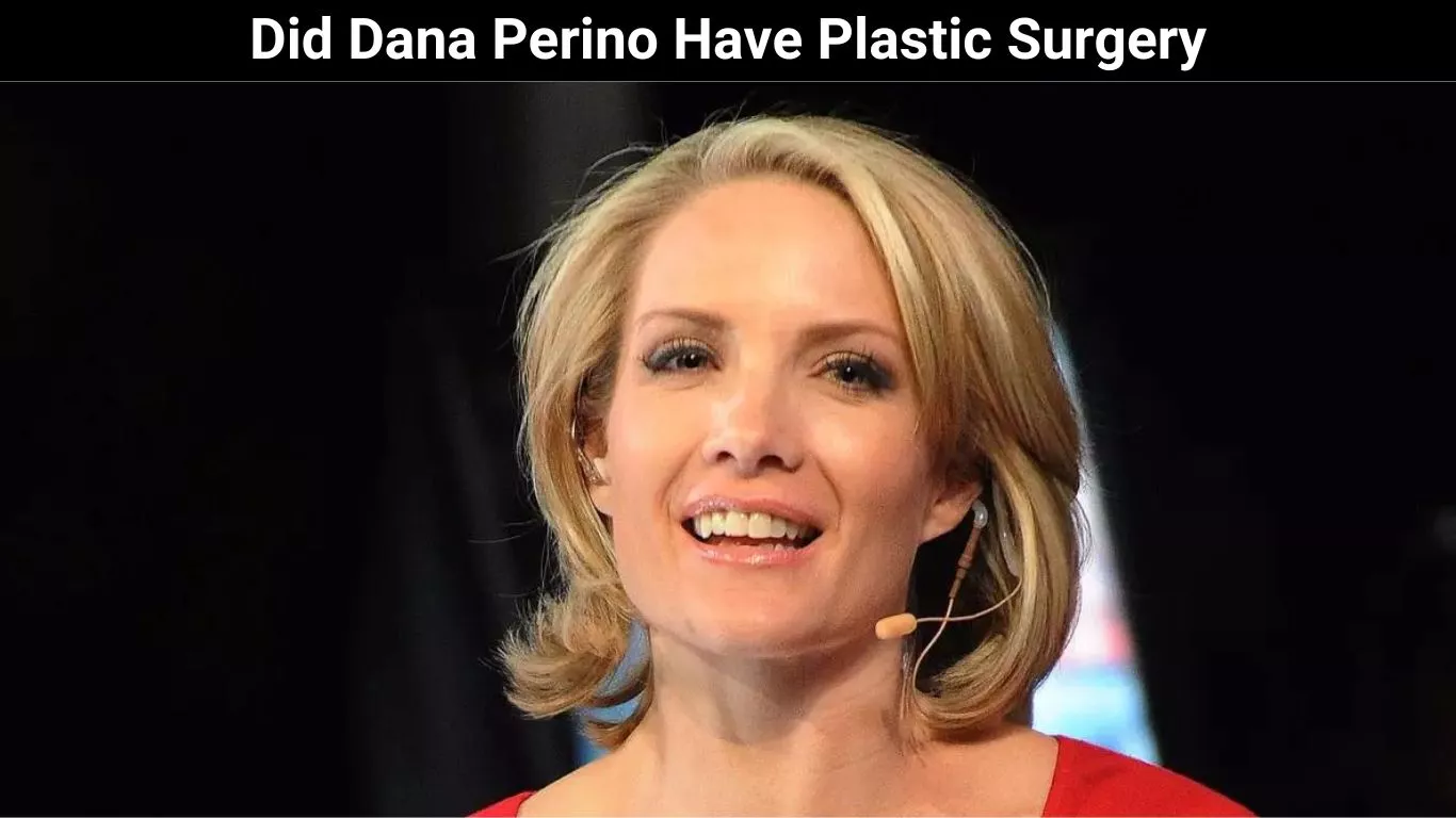 Did Dana Perino Have Plastic Surgery