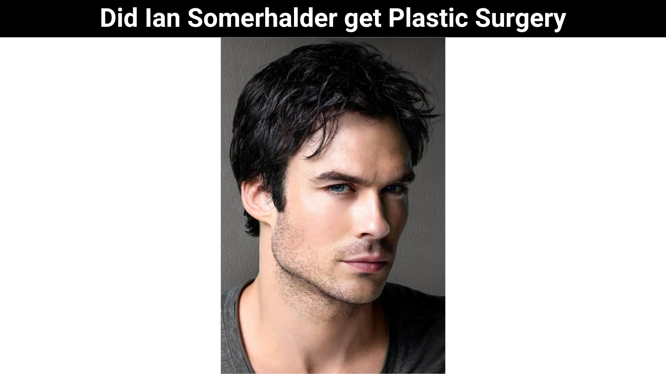 Did Ian Somerhalder get Plastic Surgery