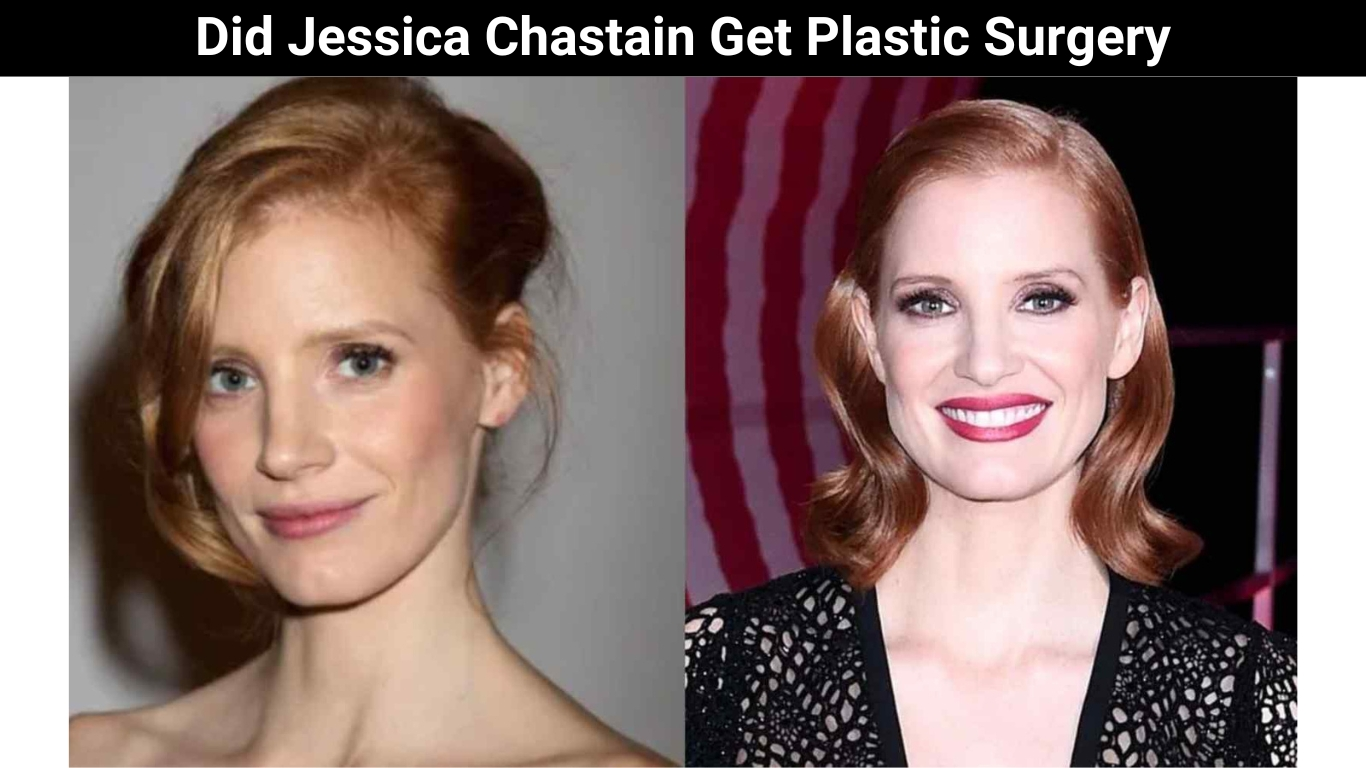 Did Jessica Chastain Get Plastic Surgery