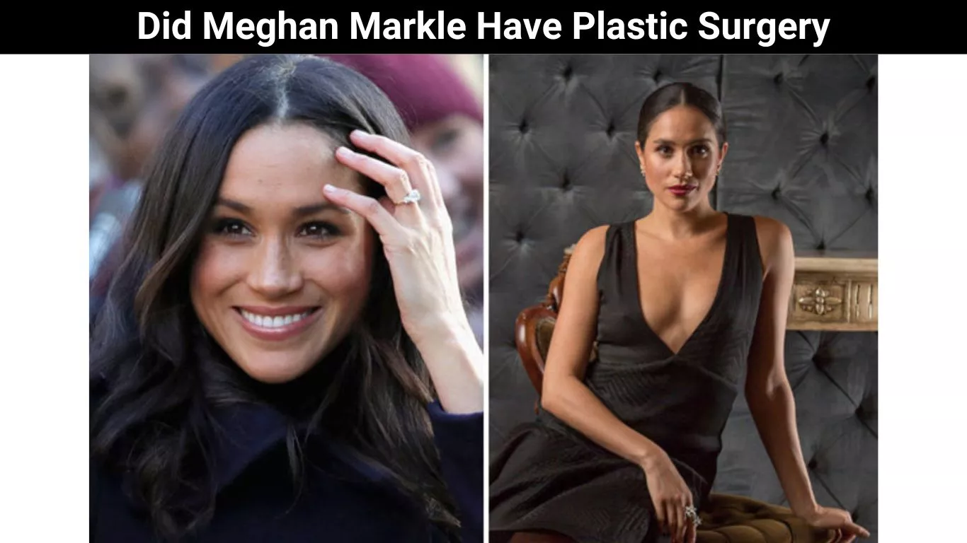 Did Meghan Markle Have Plastic Surgery
