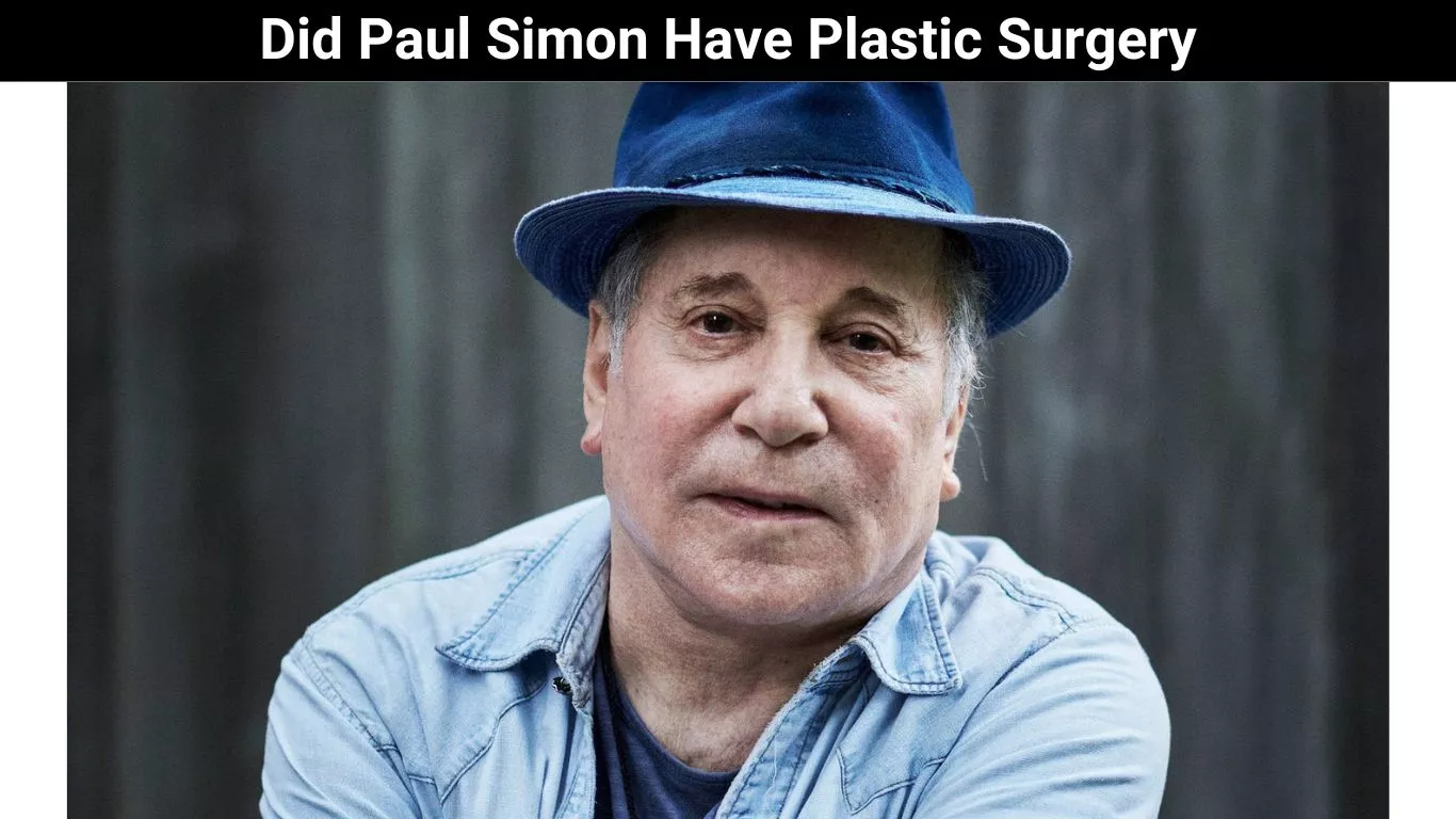 Did Paul Simon Have Plastic Surgery