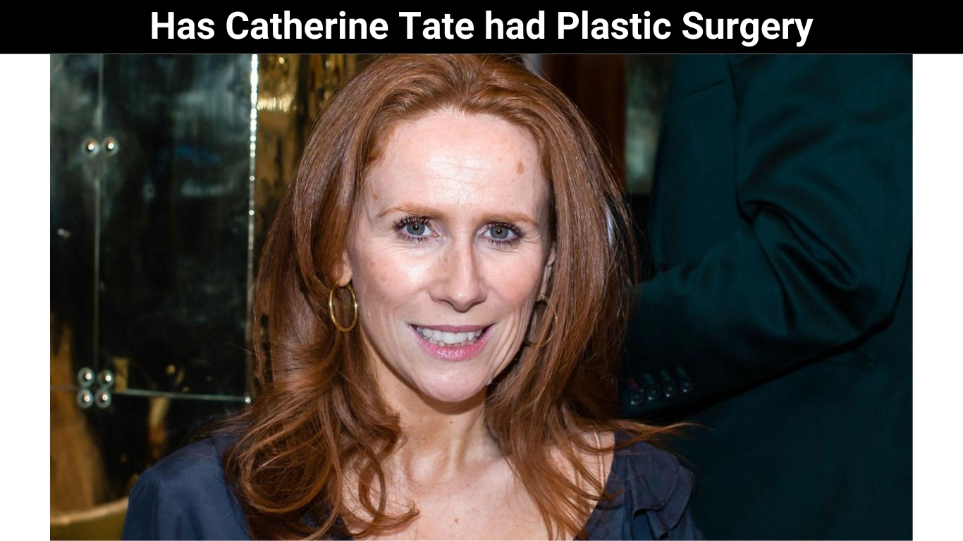 Has Catherine Tate had Plastic Surgery