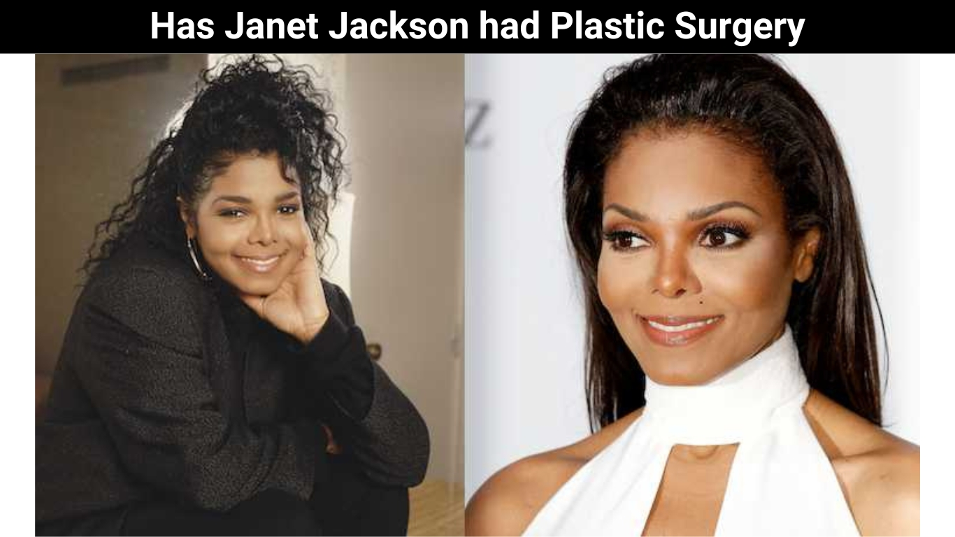Has Janet Jackson had Plastic Surgery