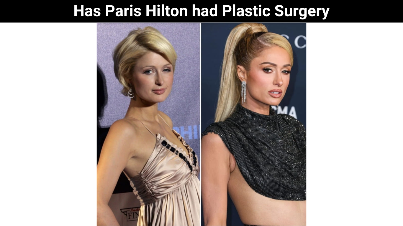 Has Paris Hilton had Plastic Surgery