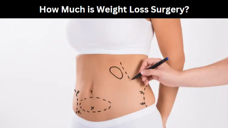 How Much is Weight Loss Surgery