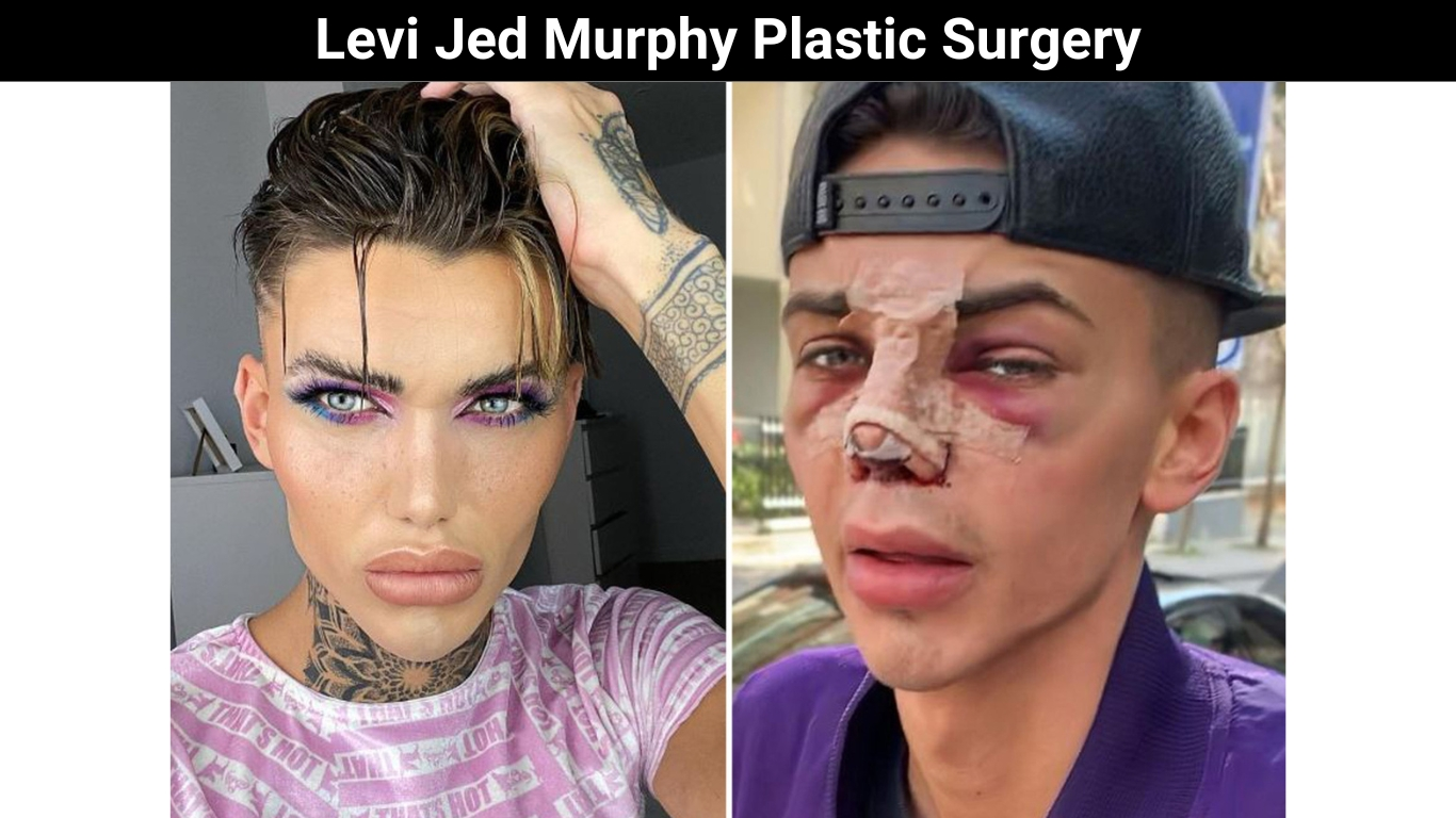 Levi Jed Murphy Plastic Surgery