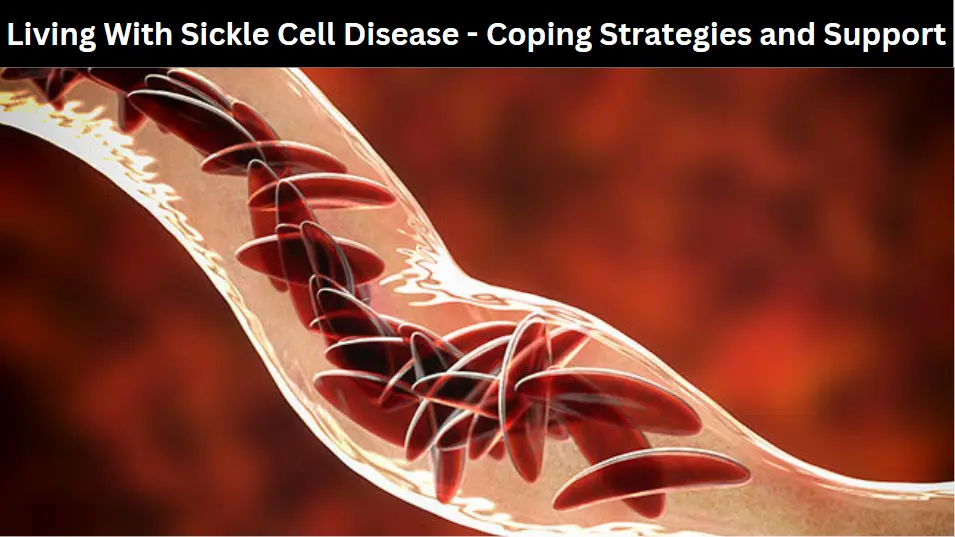 Living With Sickle Cell Disease