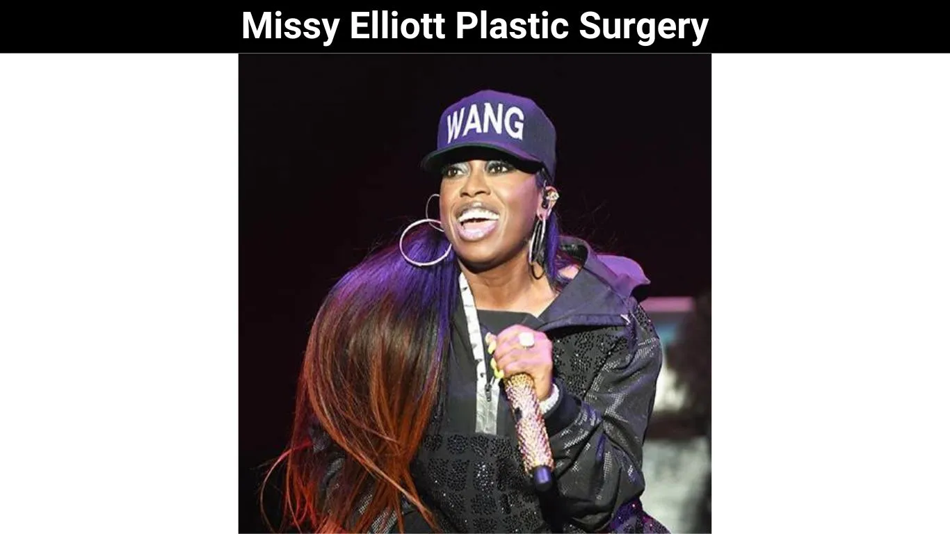 Missy Elliott Plastic Surgery