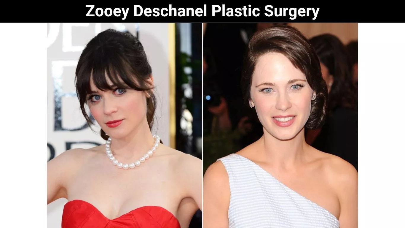 Zooey Deschanel Plastic Surgery