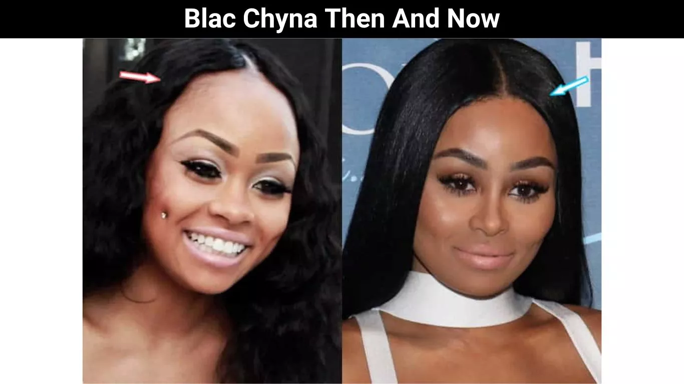 Blac Chyna Then And Now