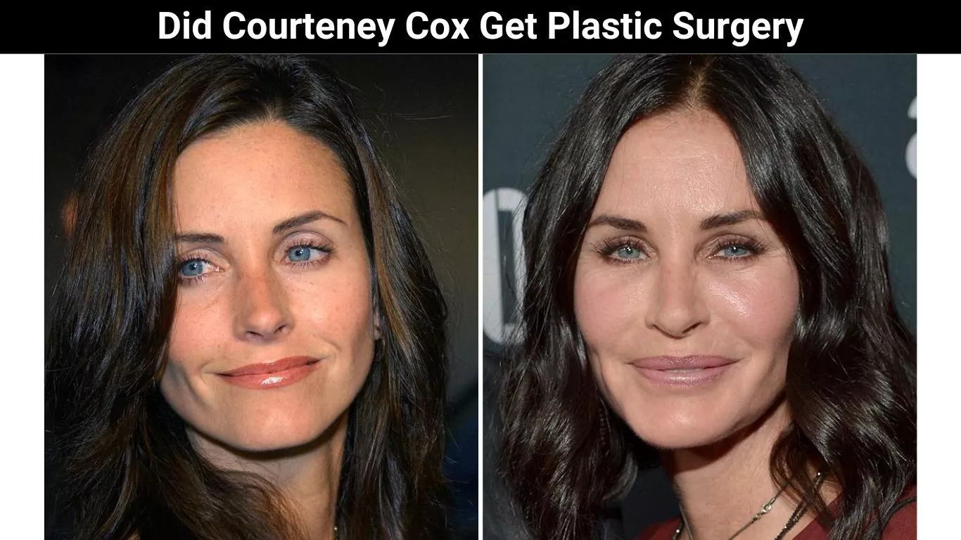 Did Courteney Cox Get Plastic Surgery
