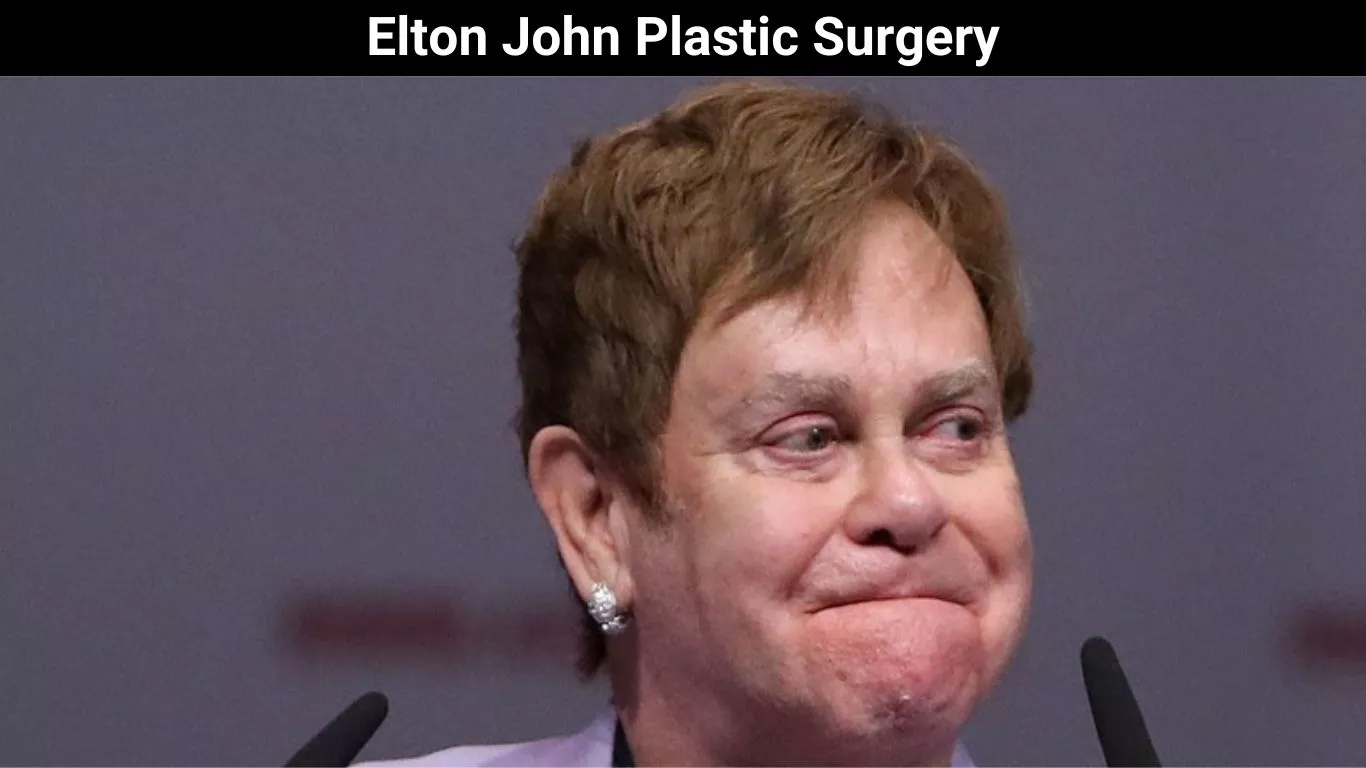 Elton John Plastic Surgery