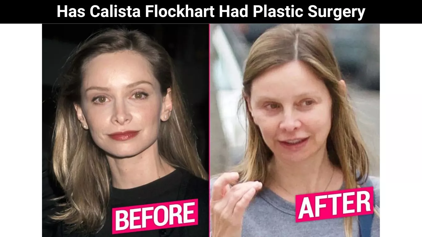 Has Calista Flockhart Had Plastic Surgery