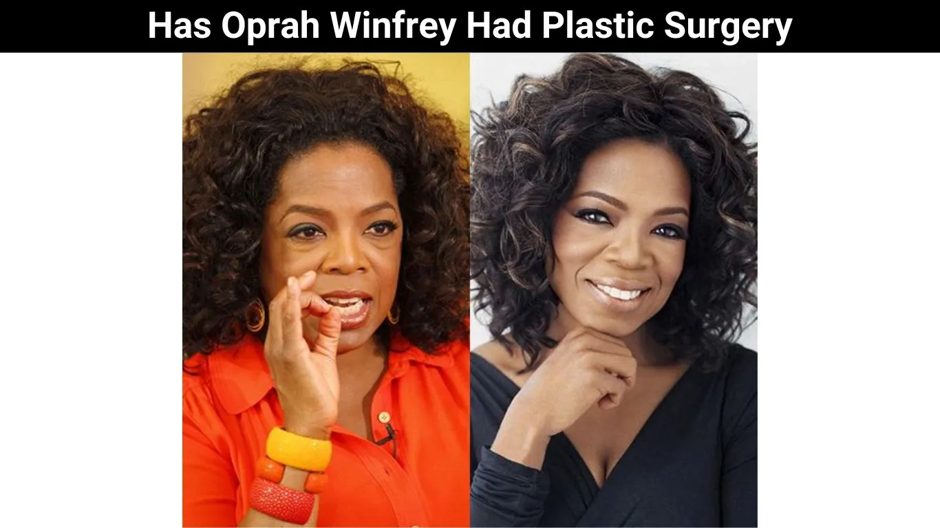 Has Oprah Winfrey Had Plastic Surgery