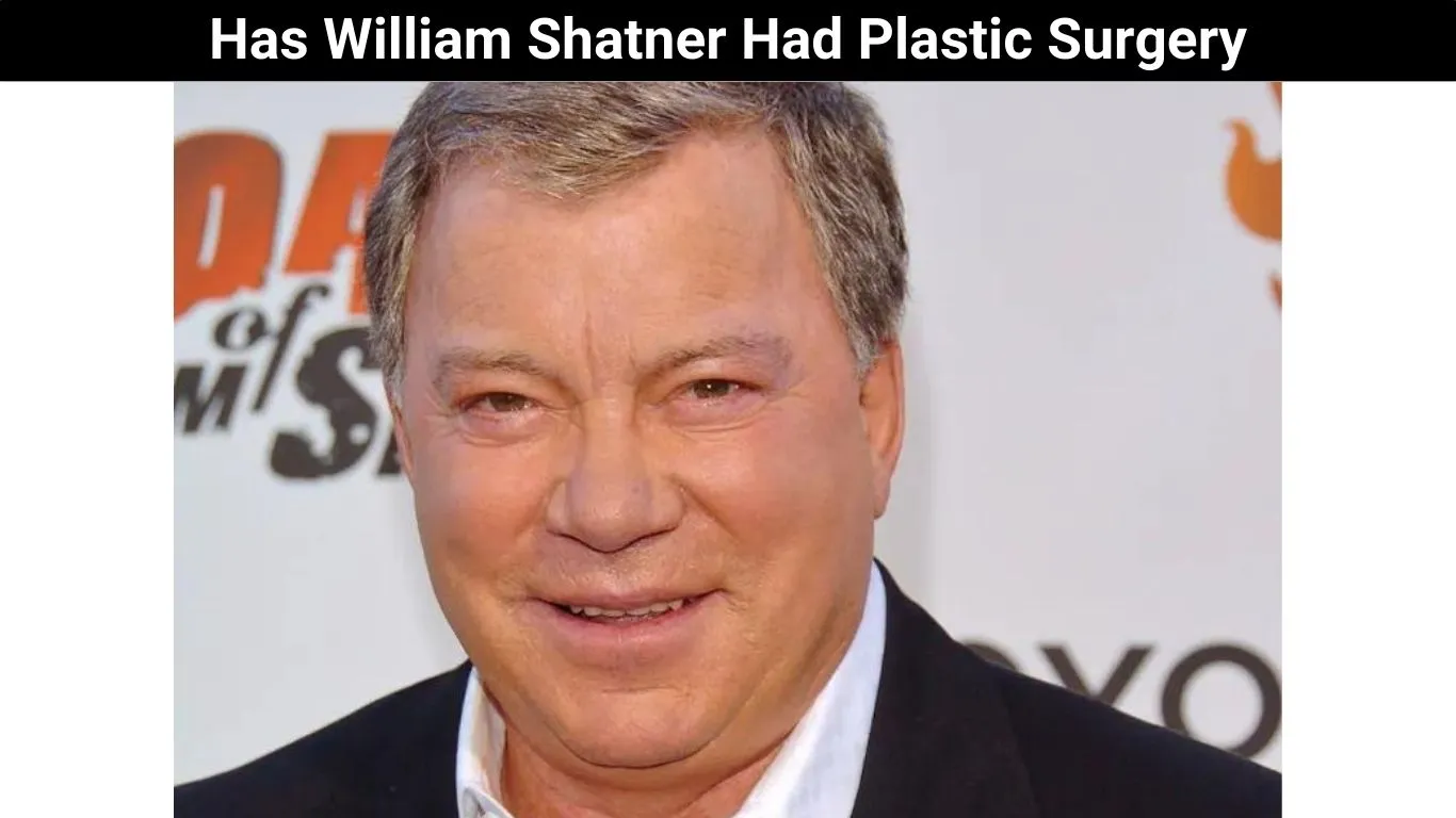 Has William Shatner Had Plastic Surgery