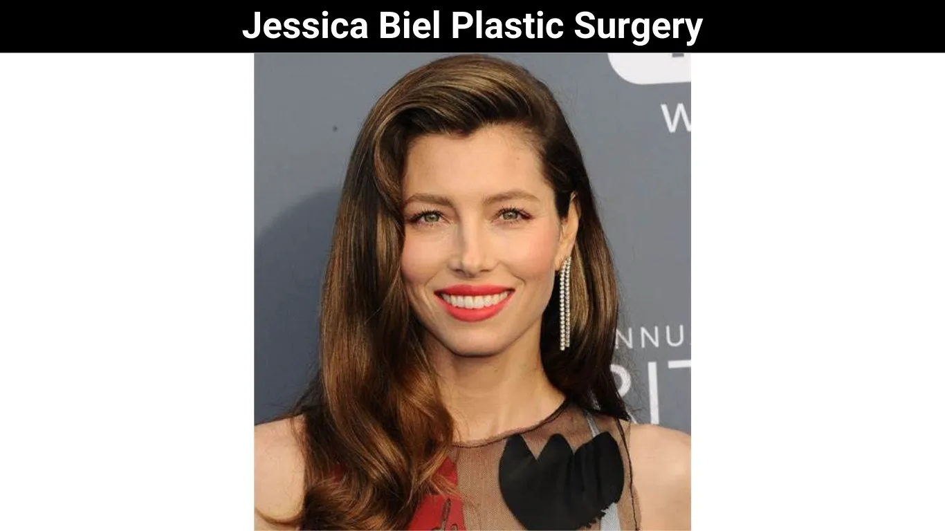 Jessica Biel Plastic Surgery