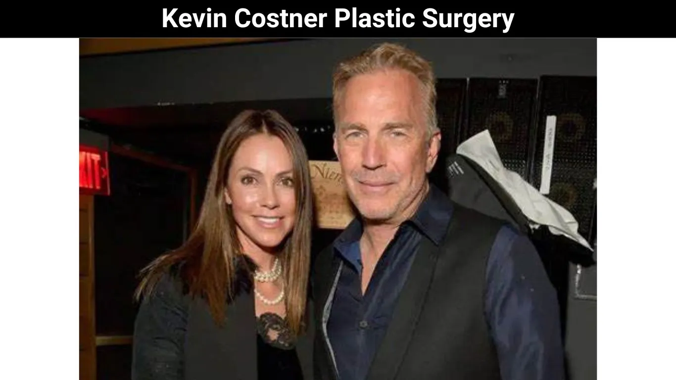 Kevin Costner Plastic Surgery