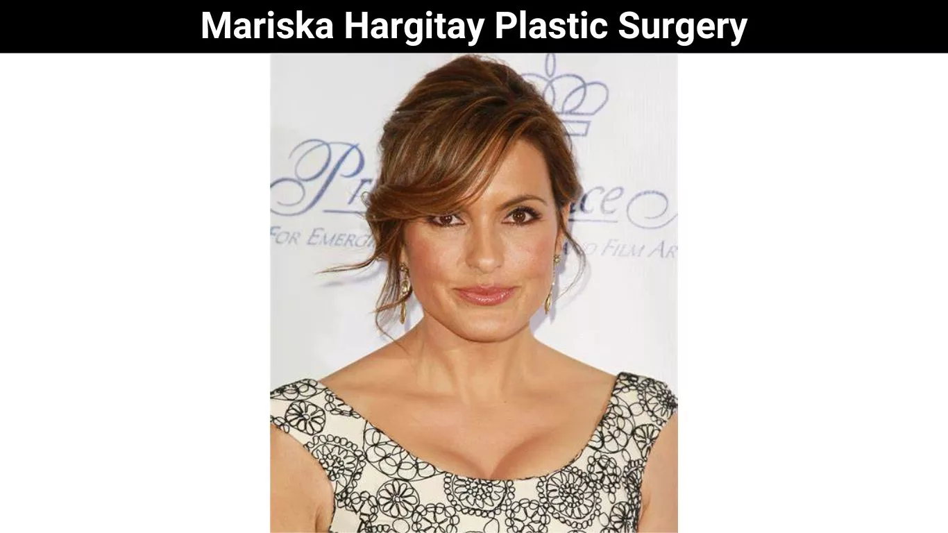 Mariska Hargitay Plastic Surgery
