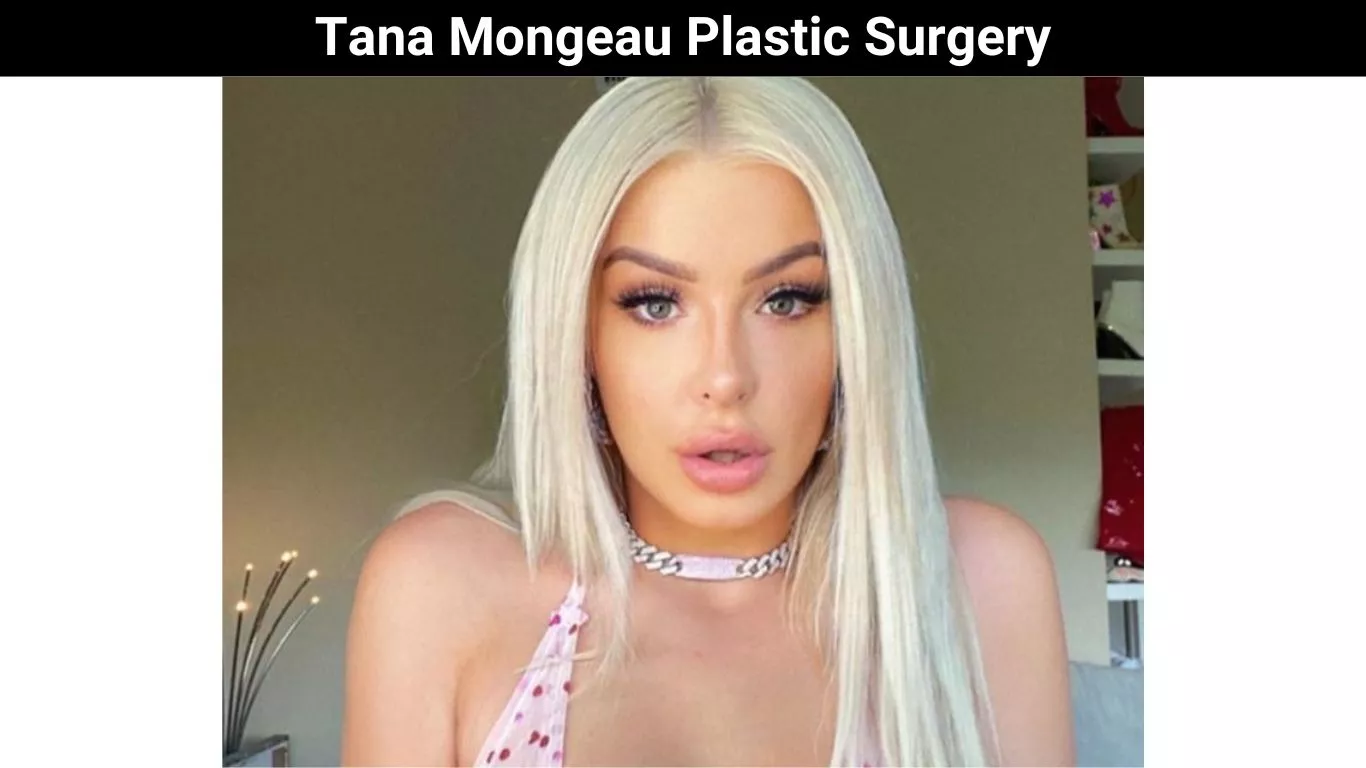 Tana Mongeau Plastic Surgery