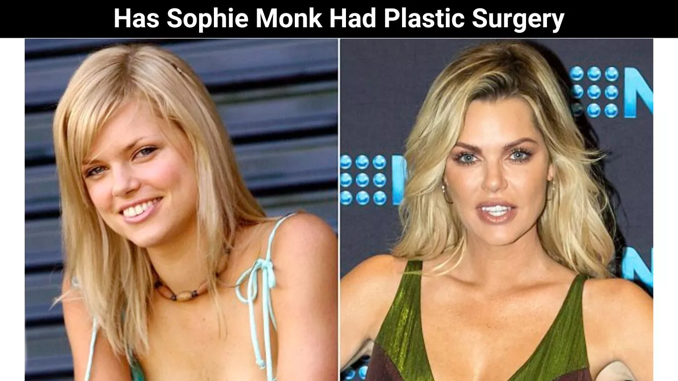 Has Sophie Monk Had Plastic Surgery