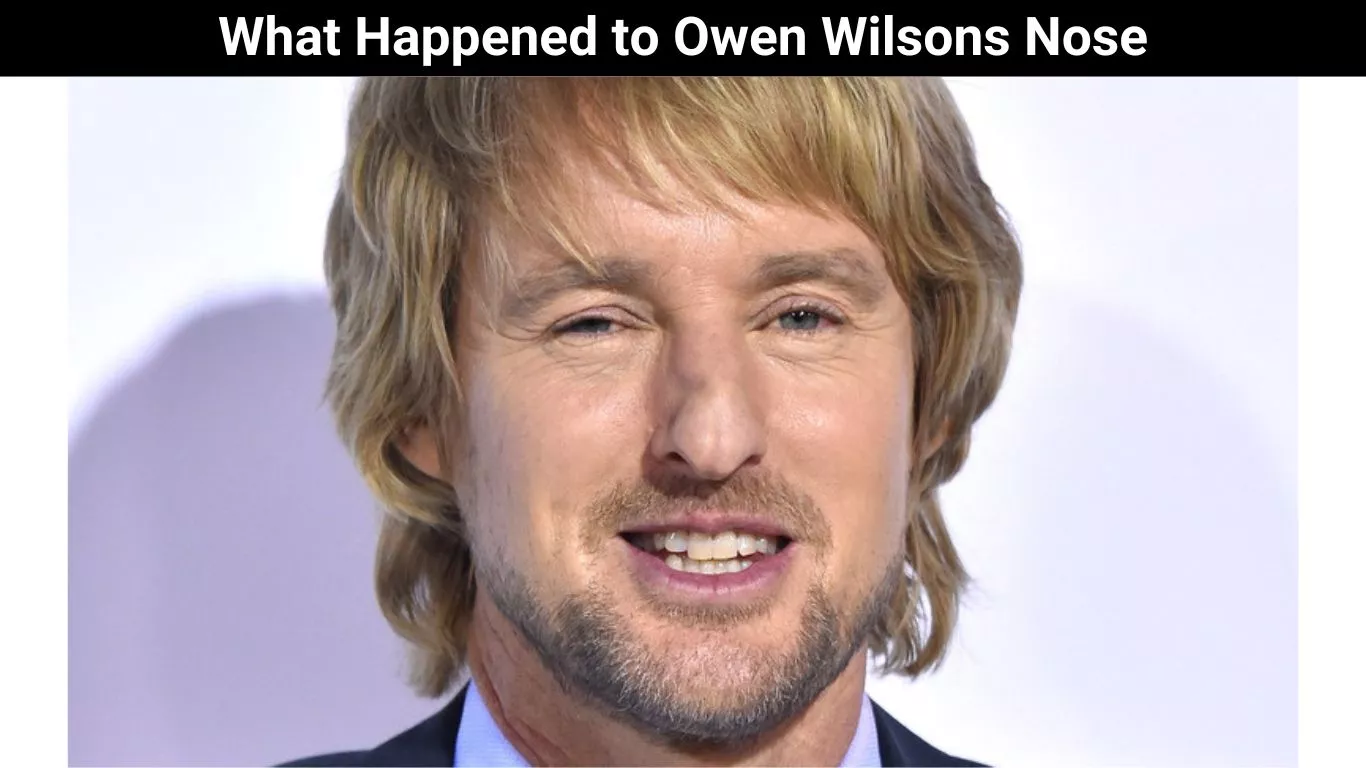 What Happened to Owen Wilsons Nose