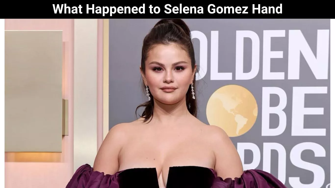 What Happened to Selena Gomez Hand