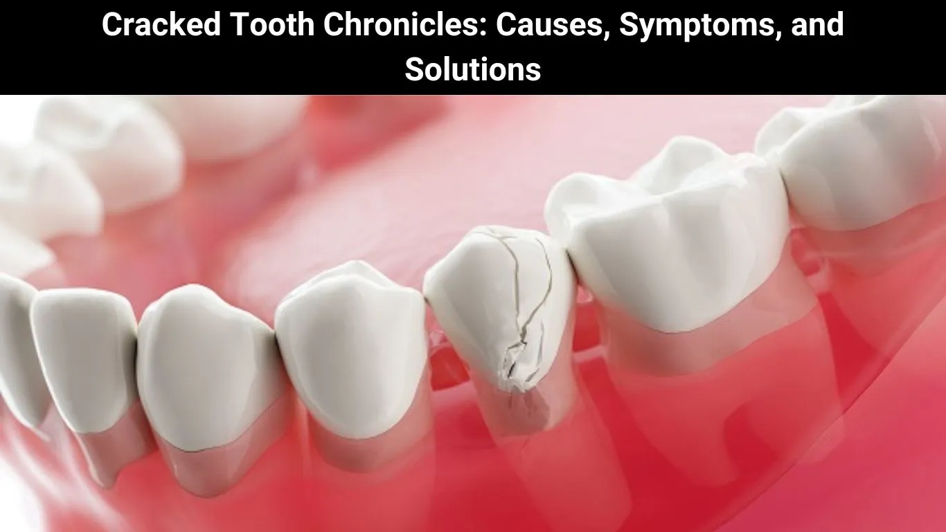 Cracked Tooth Chronicles: Causes, Symptoms, and Solutions