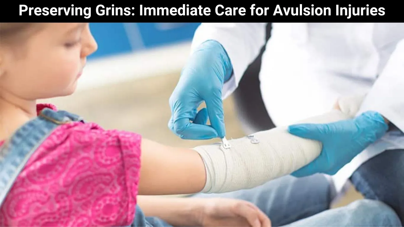 Preserving Grins: Immediate Care for Avulsion Injuries