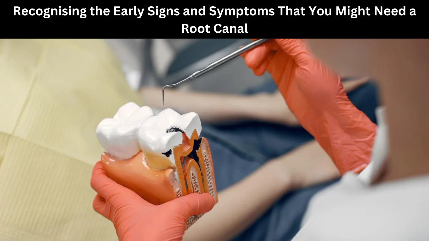 Recognising the Early Signs and Symptoms That You Might Need a Root Canal